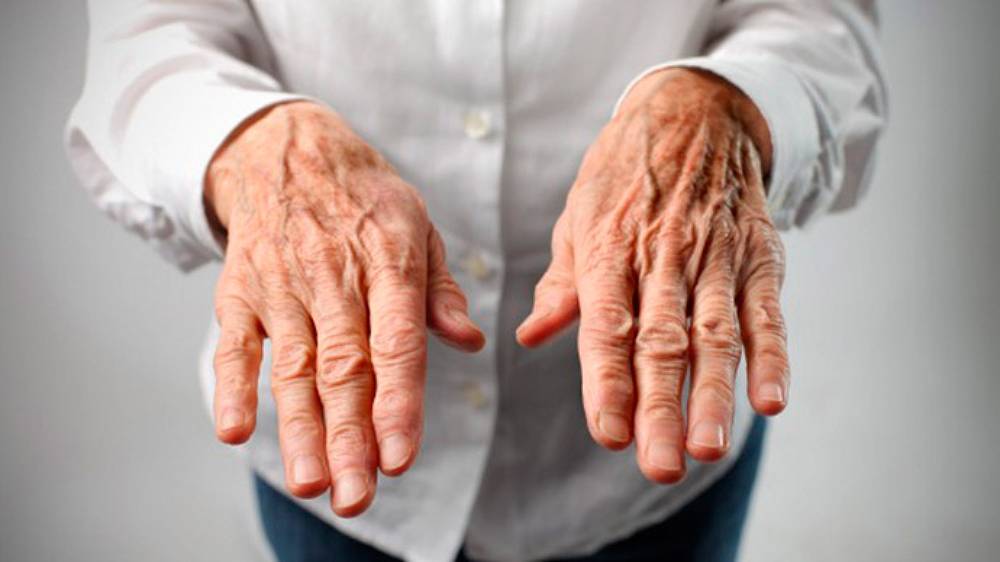Doença de Parkinson e a influência das atividades físicas 