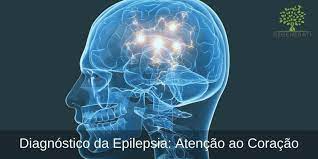 Epilepsias